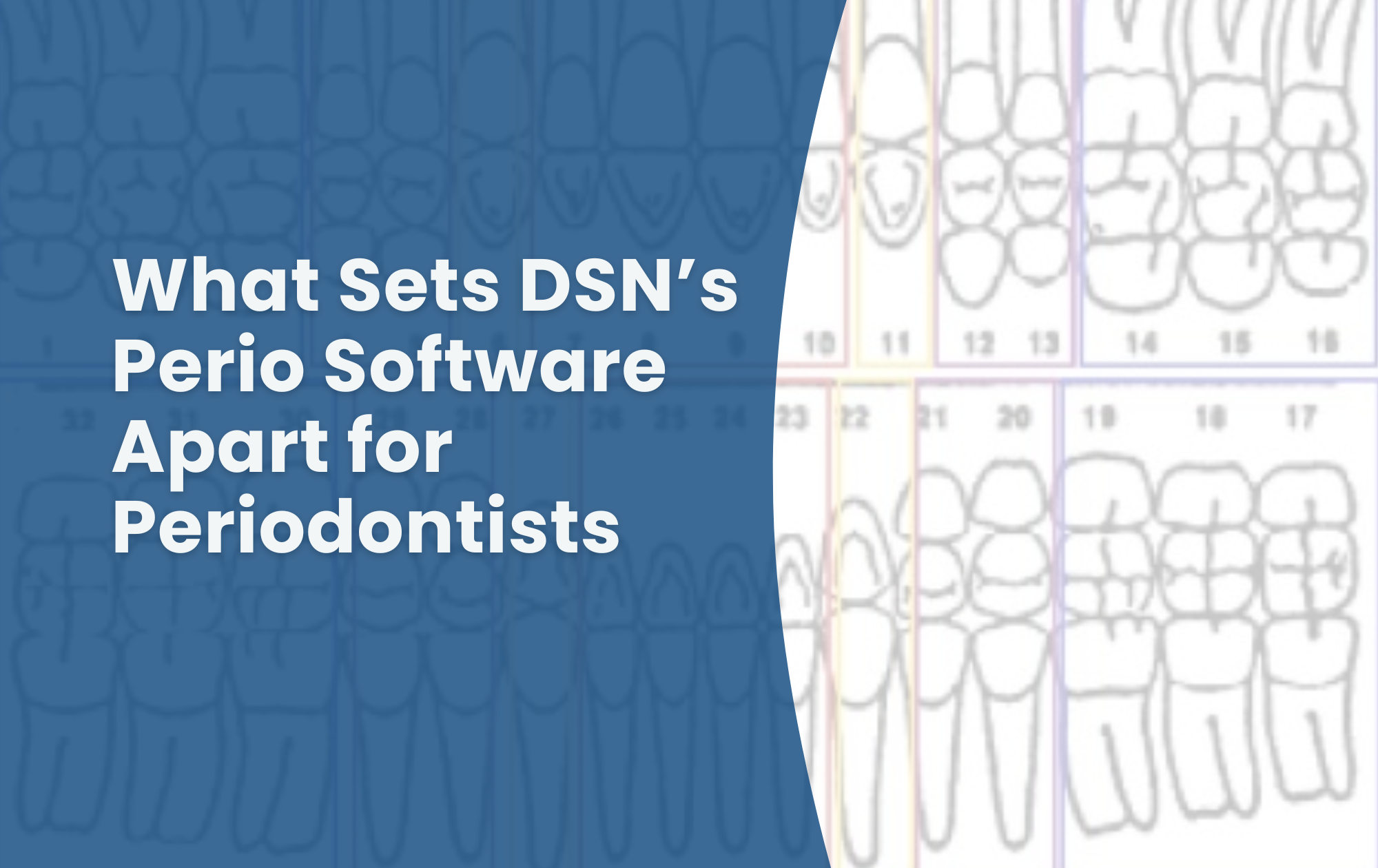 What Sets DSN’s Perio Software Apart for Periodontists